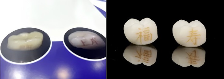 Xăm răng - xu hướng làm đẹp đang rộ lên tại một đất nước - Ảnh 1.