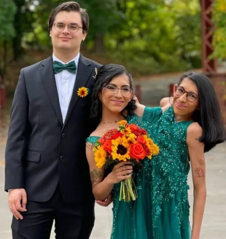 Cặp song sinh dính liền lần đầu chia sẻ cuộc sống sau hôn nhân - Ảnh 2.