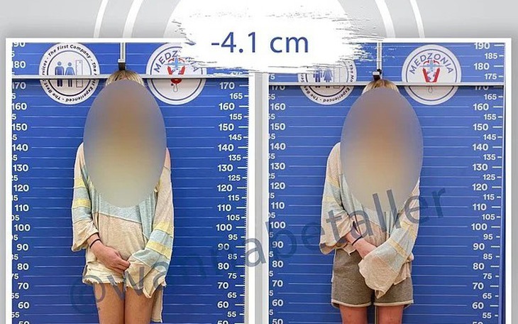 Thanh niên ăn thức ăn cho mèo để có tiền học tiến sĩ  - Ảnh 3.