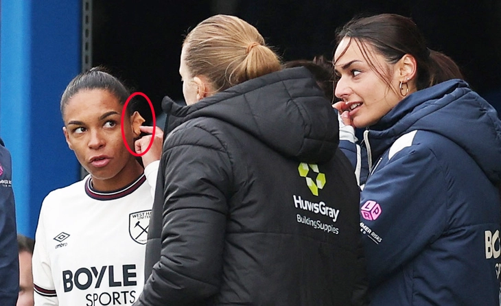 Nữ tuyển thủ Pháp không thể ra mắt CLB West Ham chỉ vì chiếc khuyên tai - Ảnh 1.