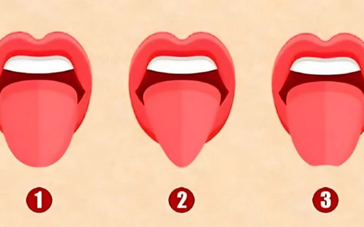 Quiz: Bạn khả năng sáng tạo nổi bật hay sở hữu tinh thần lạc quan - Ảnh 4.