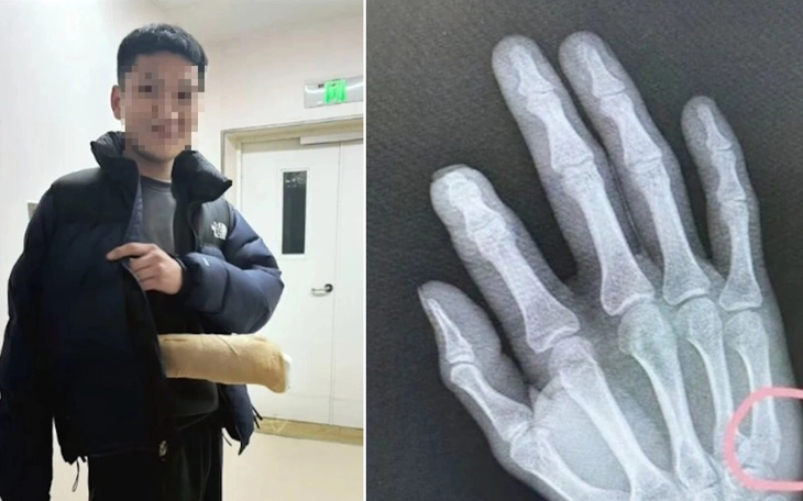 Bị tuyên hủy hôn do lời thề cưới viết bằng AI thiếu đúng một câu - Ảnh 2.