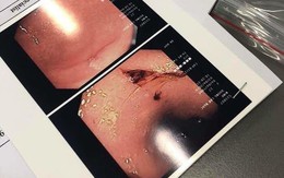 Hình ảnh Lan Ngọc kiệt sức ở phim trường được netizen đào lại