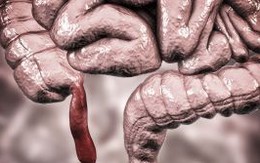 Điều gì sẽ xảy ra nếu chúng ta không có ruột thừa?