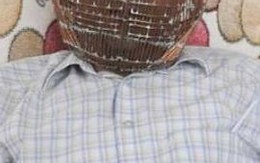 Người đàn ông tự khóa đầu mình trong lồng để cai thuốc lá