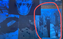 Tống Thiến đáp trả khi bị êkíp phim Triệu Lệ Dĩnh ‘trù' chết sớm