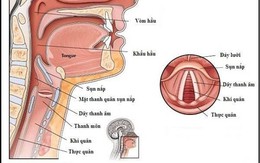 Dấu hiệu mềm sụn thanh quản ở trẻ nhỏ