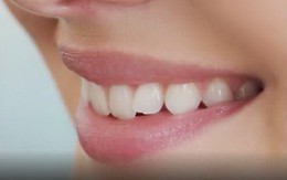 Vì sao con người lại có răng nanh?