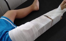Tạm đình chỉ cô giáo làm bé 3 tuổi gãy xương đùi trong lớp