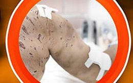 Theo bố tới chỗ làm, bé gái bị 4 con chó cắn hàng trăm vết