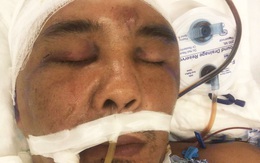 Nghi phạm nhập viện cấp cứu, hôn mê sau hai ngày bị tạm giữ