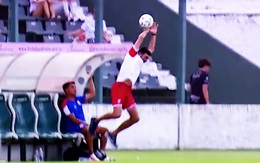 HLV thủ môn bị lỗ đầu hy hữu vì nhảy lên bắt bóng