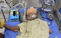 Điều tra vụ bé trai 1 tuổi chấn thương não ở trường mầm non