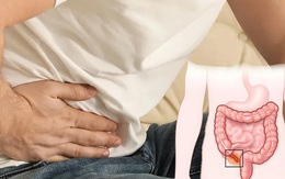 Đau bụng bất thường, cẩn trọng viêm ruột thừa cấp