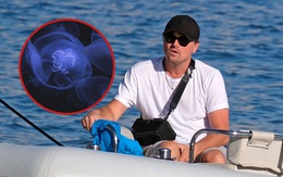 Leonardo DiCaprio bị sứa đốt khi đang hẹn hò
