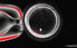 Các nhà khoa học dùng công nghệ nhân bản để hoán đổi DNA trong trứng người