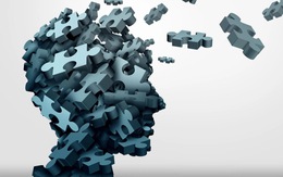 Khuyết tật nhận thức ở người trẻ: Những biểu hiện đầu tiên của 'brain rot'