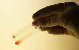 Đột phá: Biến thận nhóm máu A thành nhóm máu O, có thể ghép cho bất kỳ ai