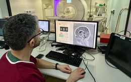 Phát hiện dị tật não nhỏ ở trẻ em mắc động kinh nhờ AI