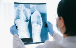 Năm 2050: Bác sĩ của bạn có thể là AI