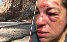 Vấp rễ cây, ngã một cái… lời 190 tỉ đồng!