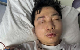 Làm rõ vụ nam DJ bị đánh hội đồng giữa phố đi bộ ở Huế