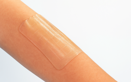 Keo sinh học dán kín vết thương chỉ trong 5 giây