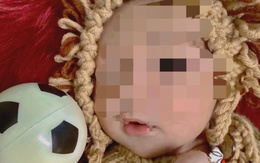 Trẻ sơ sinh 5 ngày tuổi bị thủng dạ dày vì mẹ cho ăn cơm