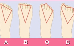 Quiz: Nhìn hình dáng bàn chân, đoán tính cách thật của bạn