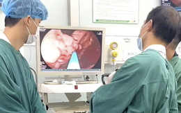 Người đàn ông đi ngoài phân đen, máu chảy thành tia trong dạ dày