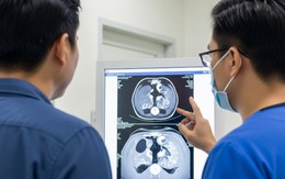 Ung thư và đột quỵ gia tăng: Có nên chụp CT để tầm soát?