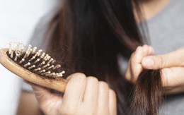 Rụng tóc 'tấn công' người trẻ Hàn Quốc