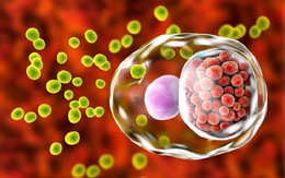 Quan hệ đồng giới không an toàn, nam thanh niên viêm họng do tác nhân hiếm gặp