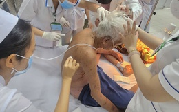 Người đàn ông 74 tuổi bị ong đốt hơn 100 vết đã tử vong