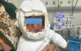 Bé 9 tháng tuổi bỏng 30% cơ thể vì kéo dây điện ấm siêu tốc