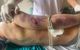 Học viên bị đánh chết sau 2 ngày nhập học: Tạm dừng hoạt động trung tâm công tác xã hội