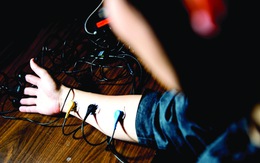 Công nghệ giúp quản lý cơn đau: cơn đau này 'AI' thấu