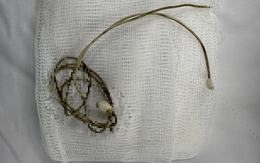 Nam sinh phải mổ khẩn vì dây sạc điện thoại trong bàng quang sau khi bắt chước clip trên mạng