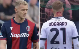 Ngôi sao Serie A bị nghi ngờ 'Zombie cắn' khi có vết đỏ kỳ lạ trên cổ