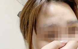 Vụ nữ sinh đi làm thêm nghi bị hành hung: Chuyên gia 'mách' cách tự bảo vệ