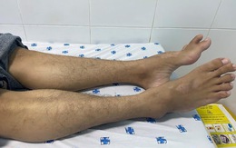 Tê yếu chi dưới lâu ngày có thể là biểu hiện của bệnh hiếm?