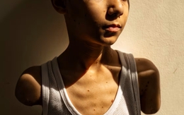 Cậu bé 9 tuổi cụt hai tay do chiến tranh: 'Làm sao con ôm mẹ được nữa?'