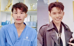 Lai Thai khoe diện mạo mới sau thẩm mỹ