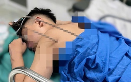 Cấp cứu nam thiếu niên bị đinh ba tự chế đâm thấu tim