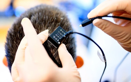 Thiết bị biến suy nghĩ thành giọng nói gần như tức thì