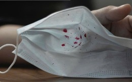 Bệnh nhiễm khuẩn gây ho ra máu ở Nga liệu có đáng lo ngại?