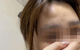 Nữ sinh tố bị hành hung vì tiền 'tip' khi đi làm thêm, công an đang xác minh