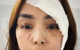 Một phụ nữ ở Nha Trang bị người không quen biết xông vào nhà rạch mặt