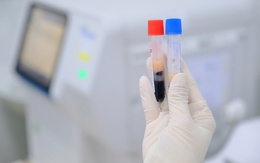 Đi khám sức khỏe phát hiện huyết thanh đục như sữa, nguy cơ đột quỵ cao