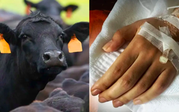 Thái Lan ghi nhận ca tử vong đầu tiên do bệnh than sau 30 năm, theo dõi 638 người